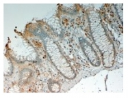 AP16570PU-N - Interleukin-12 beta / IL12B