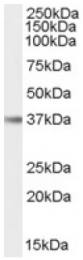 AP16570PU-N - Interleukin-12 beta / IL12B