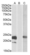 AP21268PU-N - Cystatin 8