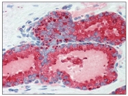 AM20265SU-N - Kallikrein-3 / PSA / KLK3
