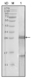 AM20265SU-N - Kallikrein-3 / PSA / KLK3
