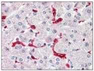 AP21303PU-N - Heme oxygenase 1 / HMOX1