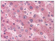 AM20266PU-N - Serum Amyloid A protein (SAA)