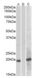 AP21275PU-N - HOXA1 / HOX1F