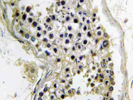AP21187PU-N - GNAT2 / GNATC