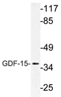 AP21185PU-N - GDF15