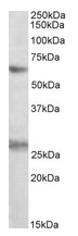 AP21288PU-N - EIF2B4 / EIF2BD