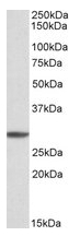 AP21301PU-N - PSMA4