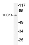 AP21169PU-N - TESK1