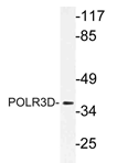 AP21167PU-N - POLR3D