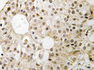 AP21165PU-N - CD3EAP