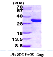 AR09738PU-L - 17-beta HSD14 / HSD17B14