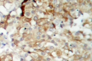 AP06177PU-N - CD221 / IGF1R