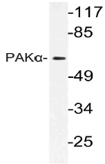AP21120PU-N - PAK1