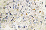 AP21125PU-N - Vitamin D3 receptor / NR1I1