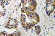 AP21131PU-N - Beta-ARK-1 / ADRBK1