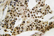 AP21135PU-N - MAPKAP Kinase-2