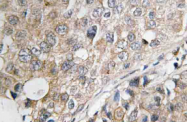 AP21137PU-N - DUSP1 / MKP1