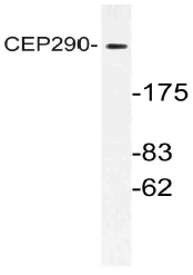AP21146PU-N - CEP290