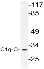 AP21152PU-N - C1q C subunit