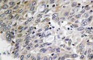 AP21152PU-N - C1q C subunit