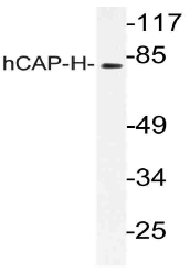 AP21157PU-N - NCAPH