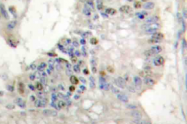 AP21050PU-N - Histone H1.0