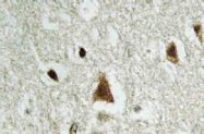 AP21054PU-N - SMAD2