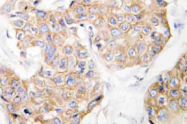 AP21055PU-N - CD213a1 / IL13RA1