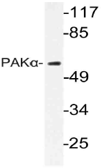 AP21056PU-N - PAK1