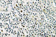 AP21057PU-N - Nucleophosmin