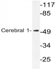 AP21059PU-N - Amyloid beta A4 protein / APP