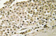 AP21059PU-N - Amyloid beta A4 protein / APP