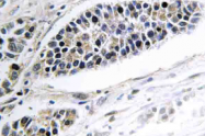 AP21062PU-N - KDEL Receptor 2 / KDELR2