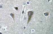 AP21063PU-N - EIF5B / IF2