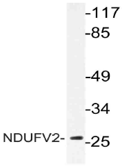 AP21067PU-N - NDUFV2