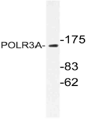 AP21068PU-N - POLR3A