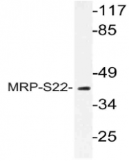 AP21073PU-N - MRPS22