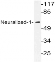 AP21079PU-N - NEURL