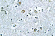 AP21079PU-N - NEURL