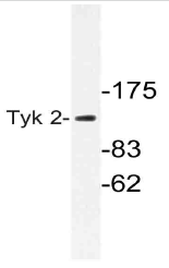 AP21083PU-N - TYK2