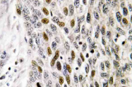 AP21087PU-N - ATF1