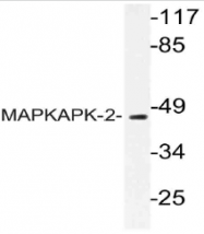 AP21090PU-N - MAPKAP Kinase-2