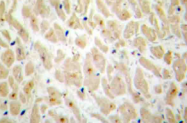 AP21090PU-N - MAPKAP Kinase-2