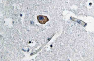 AP21093PU-N - CD171 / L1CAM