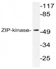 AP21094PU-N - DAPK3 / ZIPK