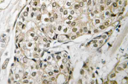 AP21107PU-N - Retinoblastoma-associated protein / RB1