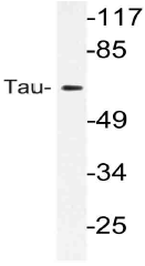 AP21109PU-N - MAPT / TAU