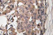 AP21110PU-N - B-Raf proto-oncogene