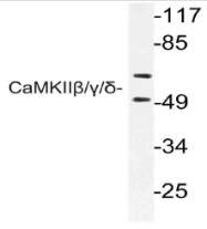 AP21111PU-N - CAMK2B/2D/2G